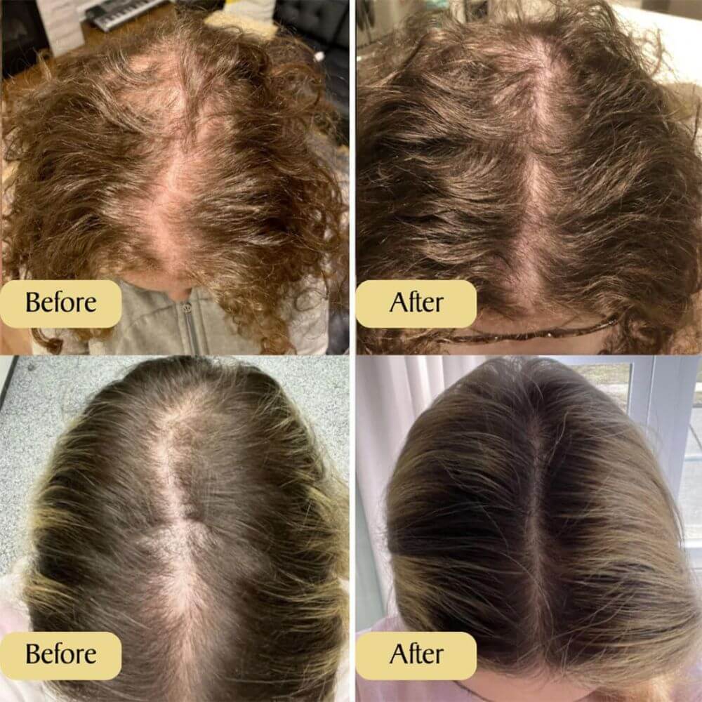 before and after photos using veganic hair oil